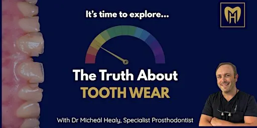 The Truth About Tooth Wear
