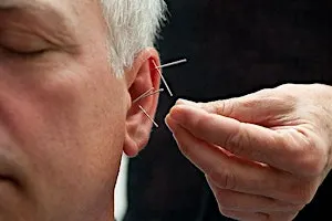 Lunchtime Reset: Community Ear Acupuncture