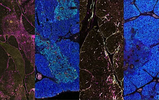 Stemness, Regeneration and Immunity: from development to therapy