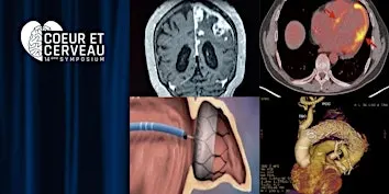 14ème Symposium Coeur et Cerveau