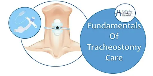 Fundamentals of Tracheostomy Care - OCT 27
