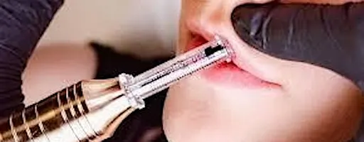 San Antonio,Tx:Hyaluron Pen Training, Learn to Fill in Lips & Dissolve Fat!