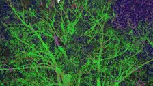 SYMBIOTIC