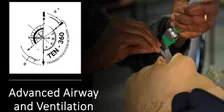 TEN-360: Advanced Airway and Ventilation 2026