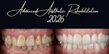Advanced Aesthetic Rehabilitation (AAR) Melbourne