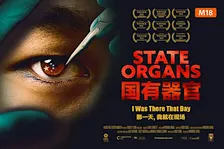 "State Organs" (M18) screening