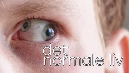 DET NORMALE LIV