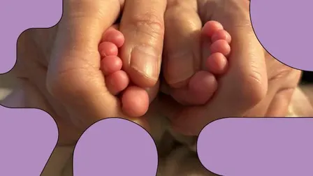 Babyzoneterapi