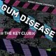 Gum Disease @ The Key Club