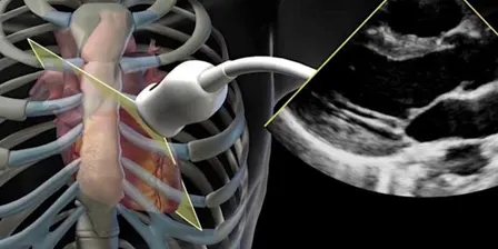 RMH Critical Care Foundation Echocardiography Course (TTE)
