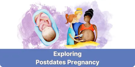 Exploring Postdates Pregnancy Sydney 2026