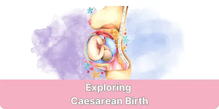 Exploring Caesarean Birth Sydney 2026