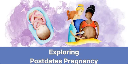 Exploring Postdates Pregnancy Sydney 2027