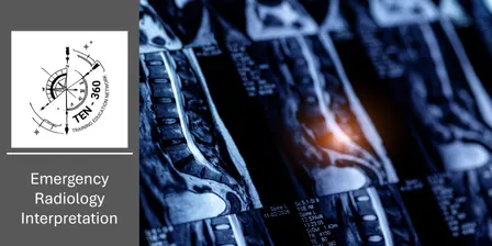 TEN-360: Emergency Radiology Interpretation 2027