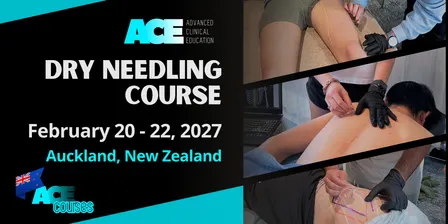 Dry Needling Course AUCKLAND NZ (20-22 FEB 2027)