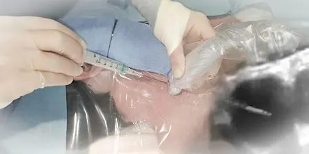 RBH Ultrasound Vascular Access Workshop