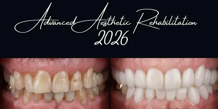 Advanced Aesthetic Rehabilitation (AAR) Melbourne