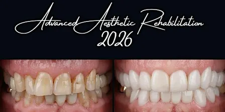 Advanced Aesthetic Rehabilitation (AAR) Melbourne