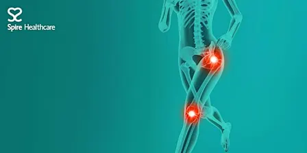 Meet the Mako - robotic knee and hip surgery information evening