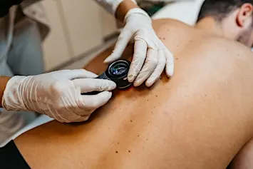 Melanoma Study Day
