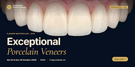 Exceptional Porcelain Veneers (EPV) Perth