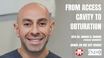 From Access Cavity to Obturation