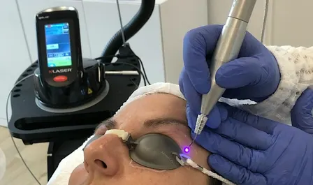 K-LASER BLUE CLINICAL LEARNING DAY
