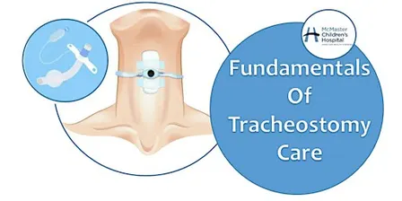 Fundamentals of Tracheostomy Care -  NOV 23