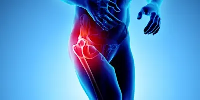 Hip Pain Workshop