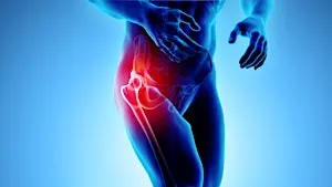 Hip Pain Workshop