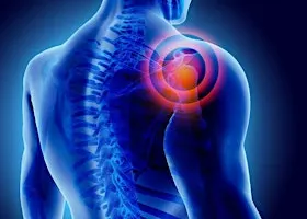 Shoulder Pain Workshop