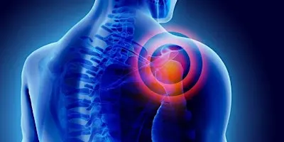 Shoulder Pain Workshop