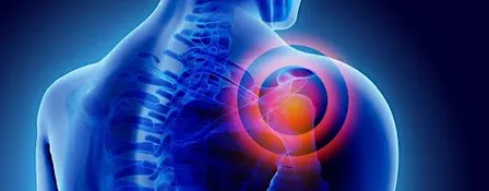 Shoulder Pain Workshop