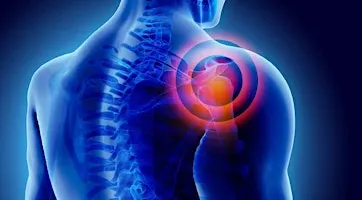 Shoulder Pain Workshop