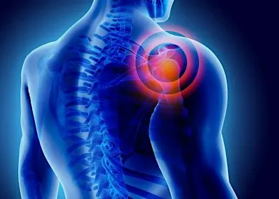 Shoulder Pain Workshop