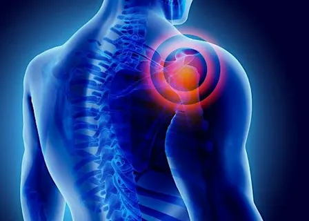 Shoulder Pain Workshop