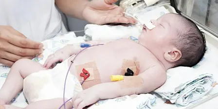 Paediatric Emergencies Intubation Course 2027