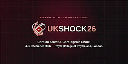 UK SHOCK 2026