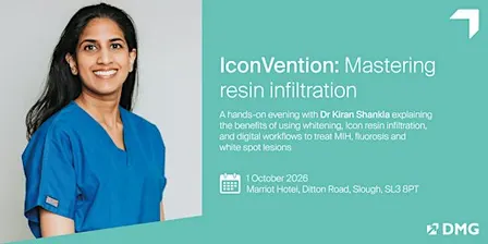 IconVention: Mastering resin infiltration
