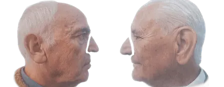 THE NOSE