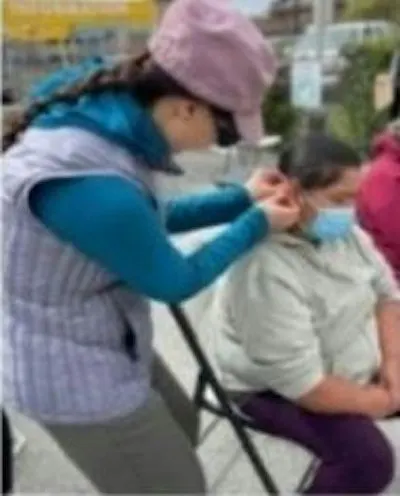 Free Community Acupuncture