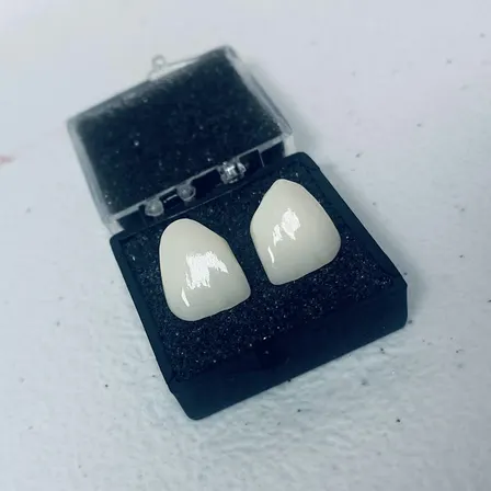 4. Anterior Zirconia Crown Finalization -3D Printed Model Hands-On Training