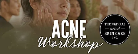 Acne Workshop: The Natural Art of Skin Care