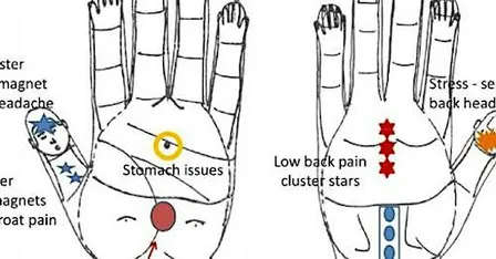 Ayurvedic Acupressure @ OSU Integrative Health