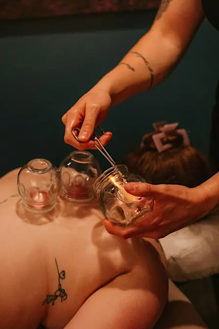 Cupping Workshop - Learn how to Cup at Home for Tight & Sore Muscles