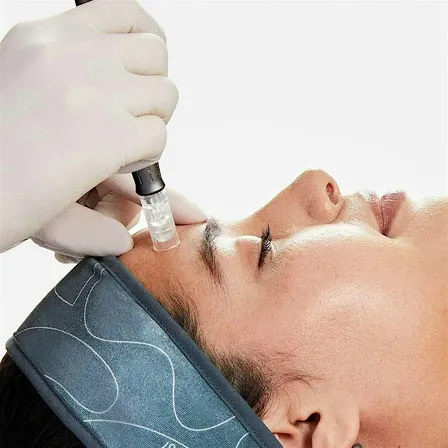 Bloom After Hours — An Exclusive Look Into Skin Needling