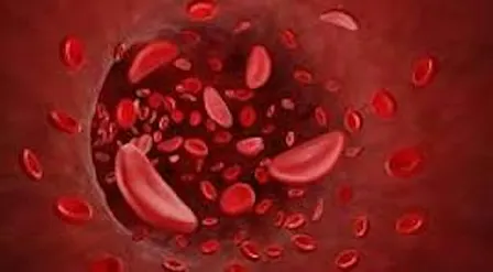 Sickle Cell Rise in Red Event