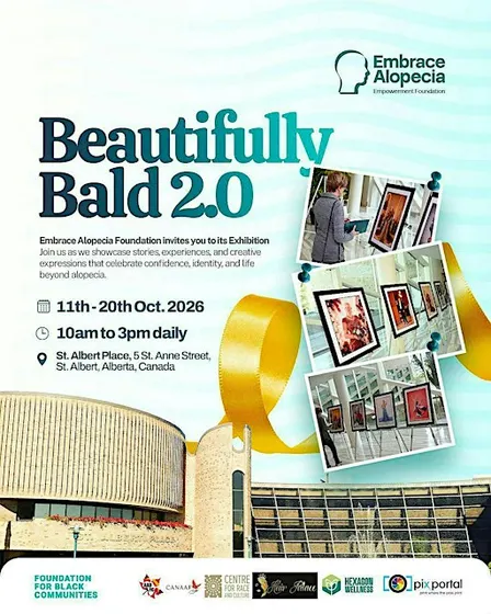 Beautifully Bald Alopecia Exhibition - St Alberta City Hall Opening