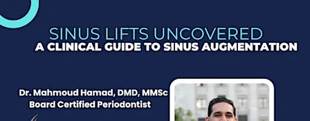 Sinus Lifts Uncovered: A Clinical Guide to Sinus Augmentation
