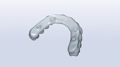 Best Practices for Digital Full Arch